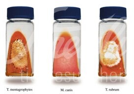 FV Dermatophyten Test DSM in Flaschen 10 Stück