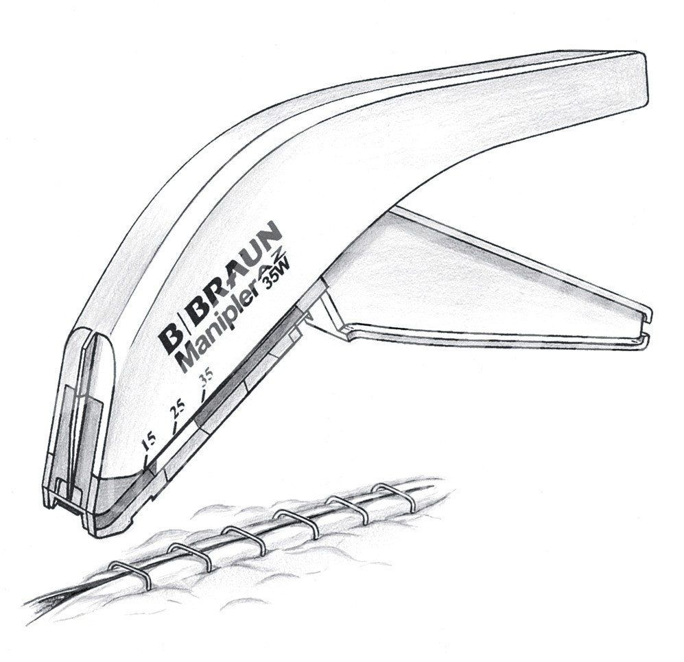 B.Braun Hautklammergerät Manipler AZ-35W 1 Stück
