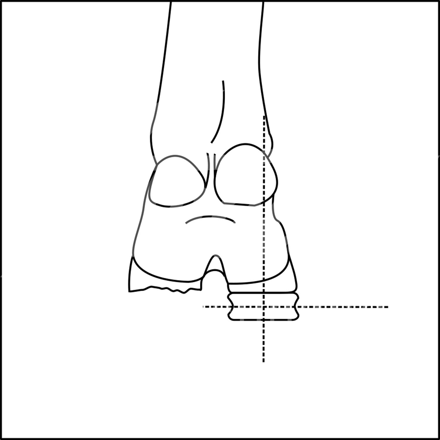 KRUUSE Klauenkleber 2-Komp.-Polyurethan 200 ml Kartusche