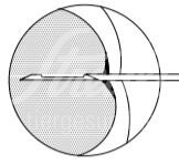 FV SuperCore Biopsienadel halbautom. 18G 1.2 mm x 9 cm 1 Stk. FV SuperCore Biopsienadel halbautom. 18G 1.2 mm x 9 cm 1 Stk.